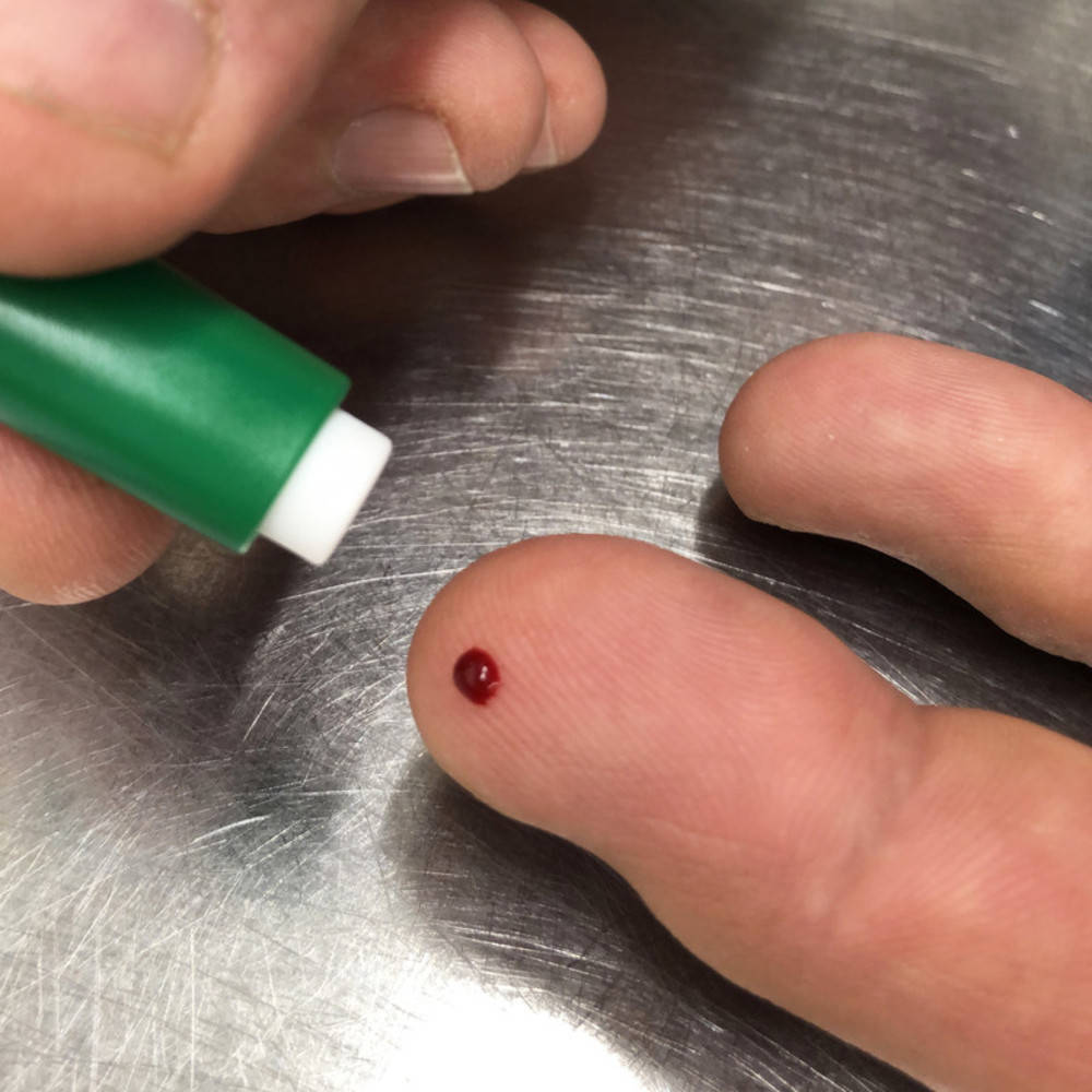 Blutgruppe Schnelltest Eldon